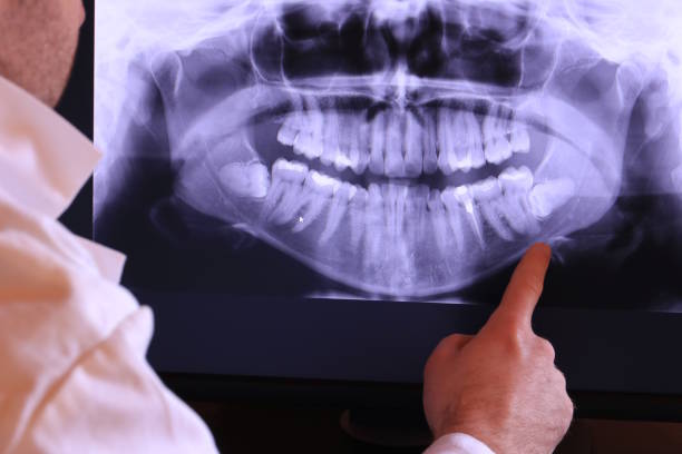 Best Emergency Dentist for Lost Fillings or Crowns in Preston Heights, IL