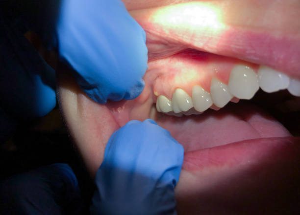 Best Emergency Dental Services for Seniors in Preston Heights, IL